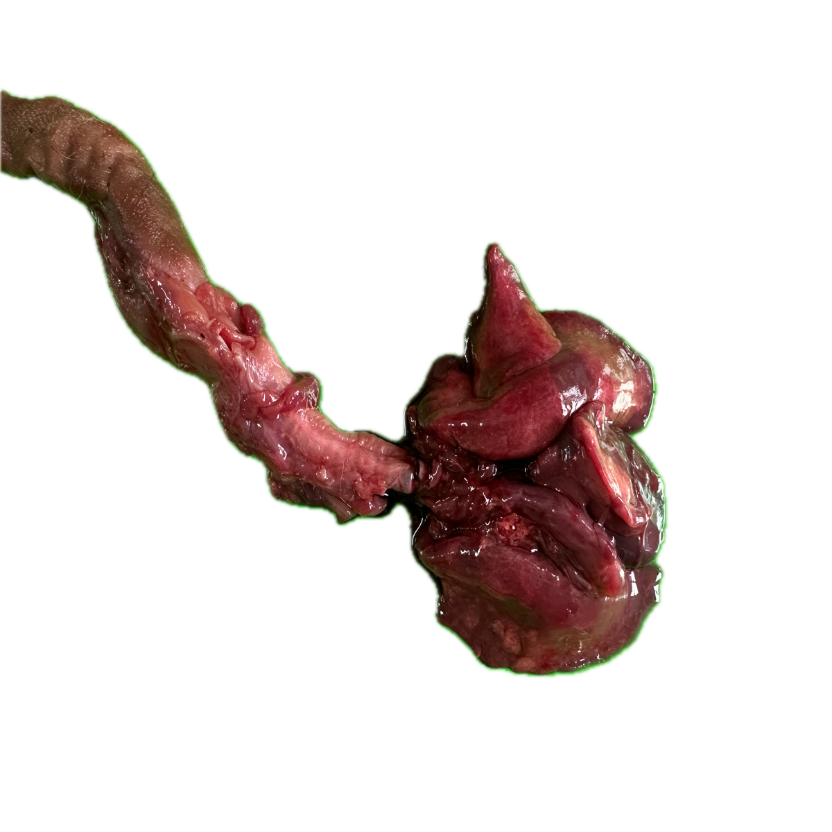 Patología Pulmonar 19
