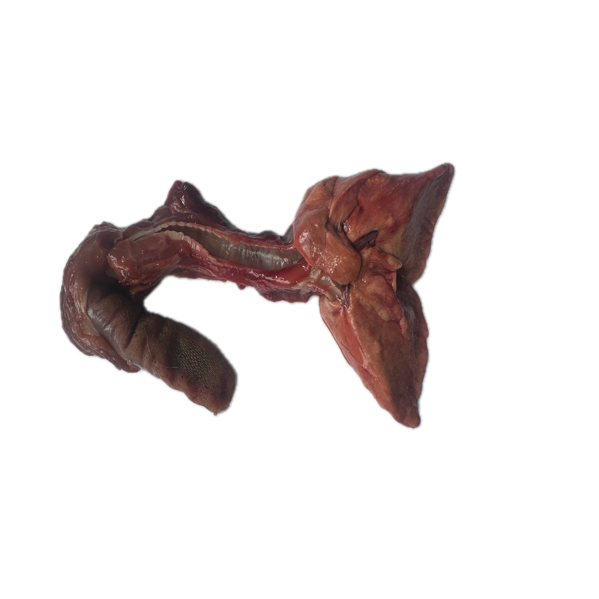 Patología Pulmonar 4