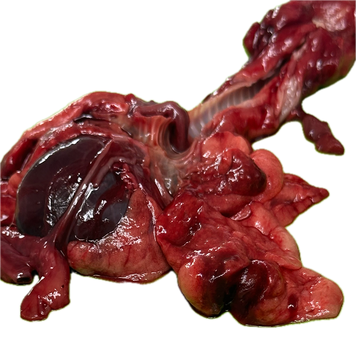 Patología Pulmonar 7