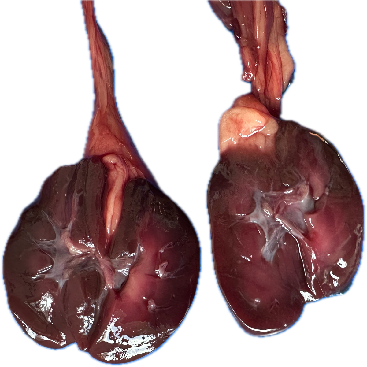 Patología Renal 1