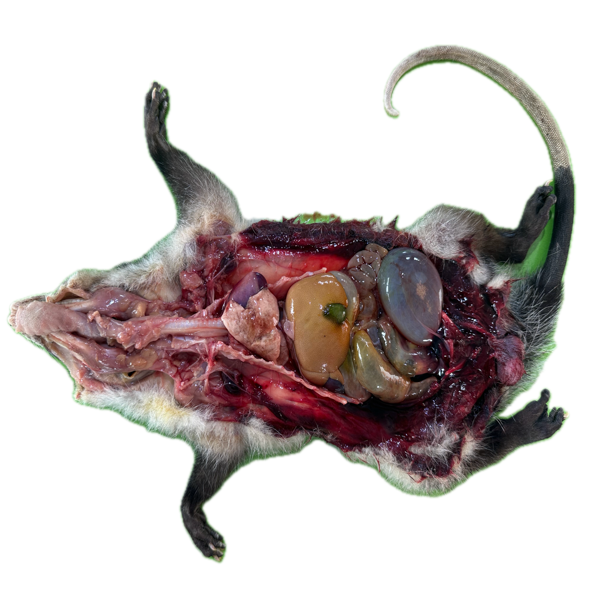 Patología Vesical 3