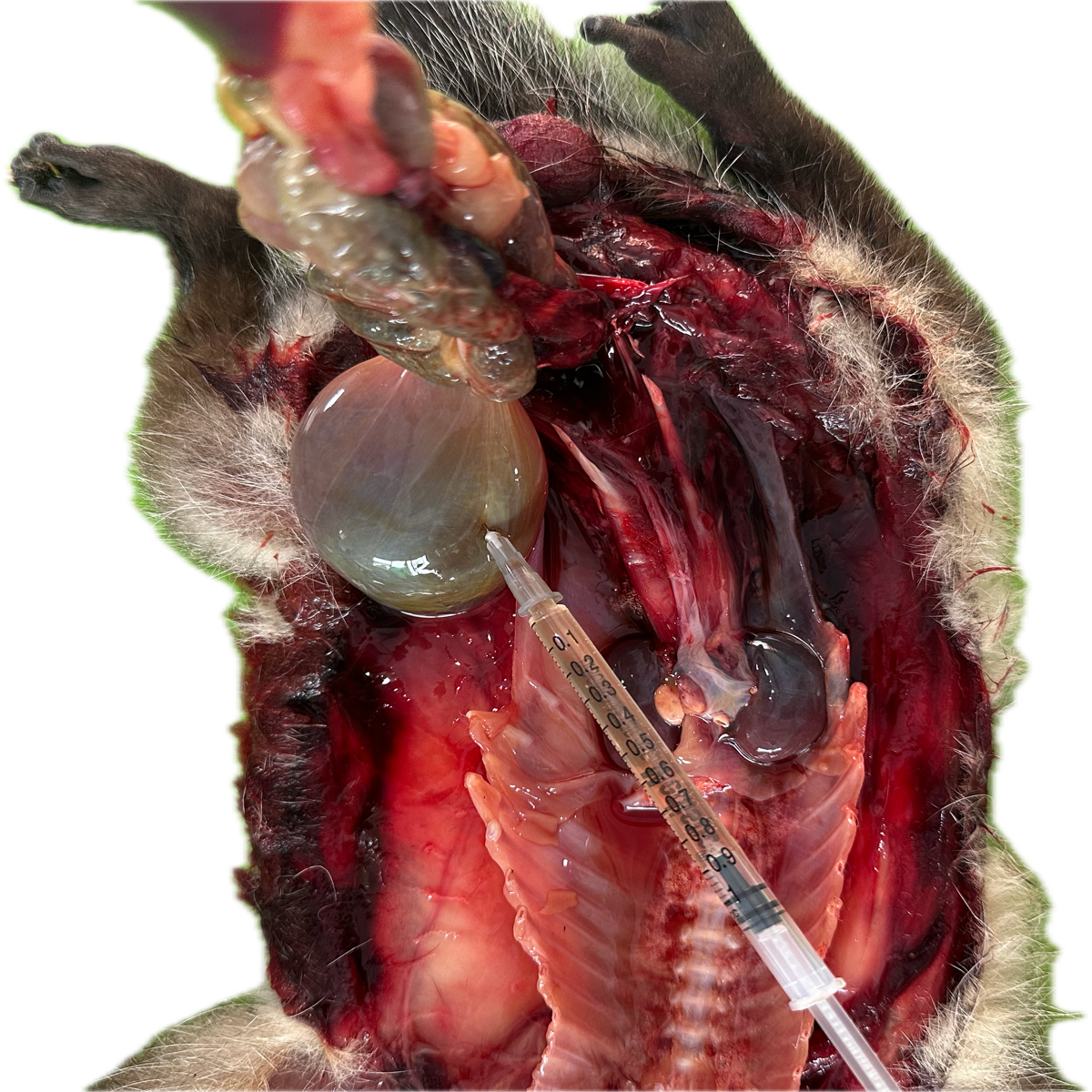 Patología Vesical 4