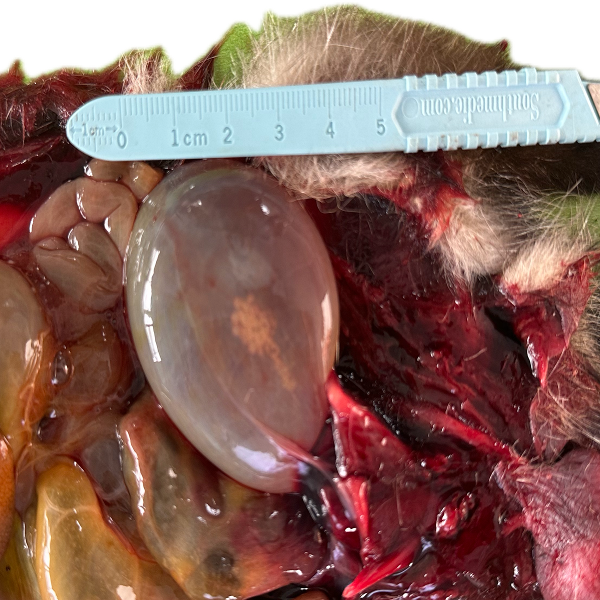 Patología Vesical 6