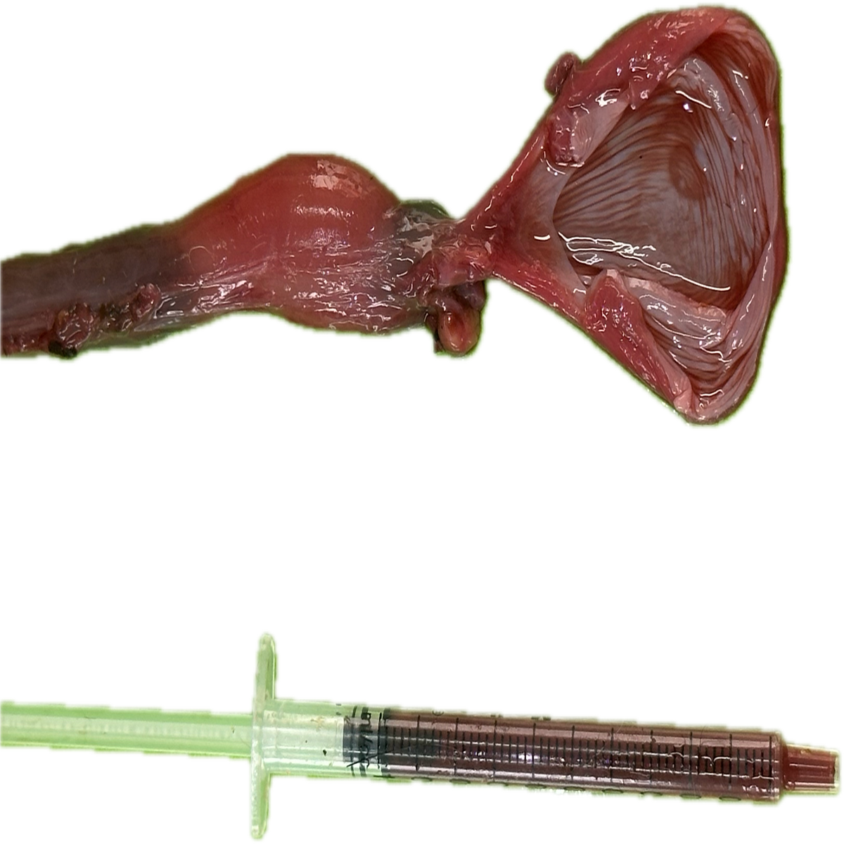 Patología Vesical 7